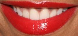 Picture of Taraji P Henson teeth and smile