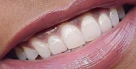 Picture of Taraji P Henson teeth and smile