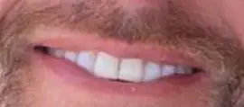 Picture of Tarek El Moussa teeth and smile