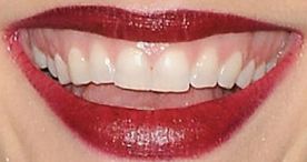 Picture of Teresa Palmer teeth and smile