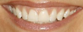 Picture of Terri Conn teeth and smile