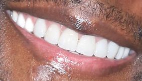Terry Crews' teeth while smiling