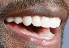 Terry Crews' teeth