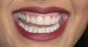 Picture of Tessa Thompson teeth