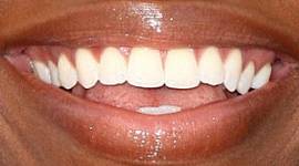 Picture of Teyonah Parris teeth and smile