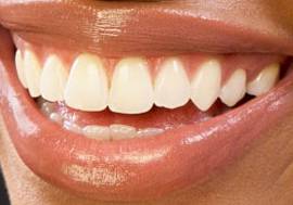 Picture of Teyonah Parris teeth and smile