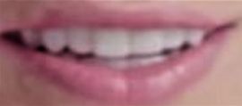 Picture of The Kid Laroi teeth and smile