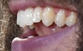 Picture of Thomas Rhett teeth and smile