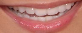 Picture of Tila Tequila teeth and smile