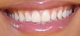 Picture of Tina Kunakey teeth and smile