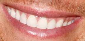 Tom Brady's teeth and smile