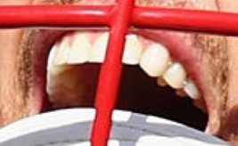 Tom Brady's teeth and smile