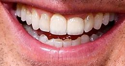 Picture of Tom Cruise's teeth while smiling