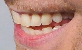 Picture of Tom Hiddleston teeth and smile