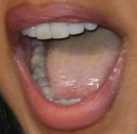 Picture of Toni Braxton teeth and smile