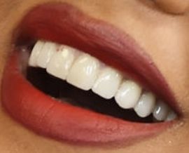 Picture of Toni Braxton teeth and smile