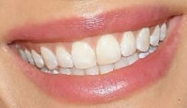 Picture of Torrey DeVitto teeth and smile