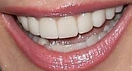 Picture of Tracey E Bregman teeth and smile