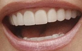 Picture of Tracey E Bregman teeth and smile