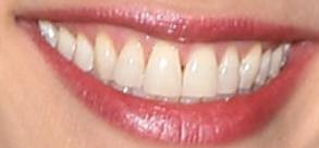 Picture of Tracy Spiridakos teeth and smile