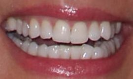 Picture of Tricia Helfer teeth and smile