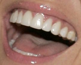 Picture of Trista Sutter teeth and smile