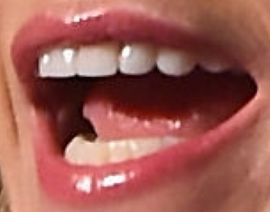 Picture of Trista Sutter teeth and smile