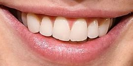 Picture of Troye Sivan teeth and smile