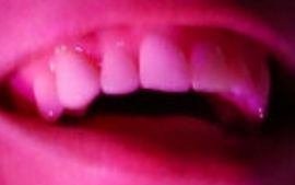 Picture of Troye Sivan teeth and smile