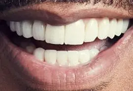 Picture of Tyler Perry teeth and smile