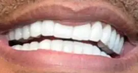 Picture of Tyler Perry teeth and smile