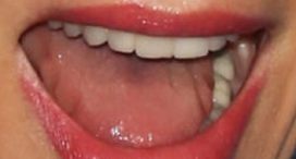 Uma Thurman teeth