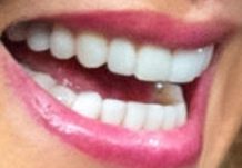 Uma Thurman teeth