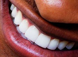 Picture of Usher teeth and smile