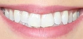 Picture of Vanessa Carlton teeth and smile