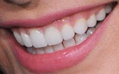 Picture of Vanessa Hudgens teeth and smile