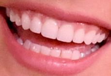 Picture of Vanessa Hudgens teeth and smile