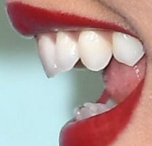 image of Victoria Justice's teeth