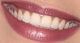 Picture of Victoria Konefal teeth and smile
