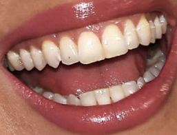 Picture of Whitney Cummings teeth and smile