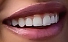 Picture of Whitney Peak teeth and smile