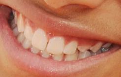 Picture of Willow Smith teeth and smile