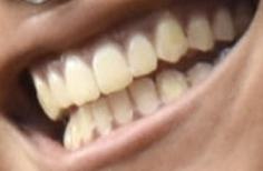 Picture of Willow Smith teeth and smile