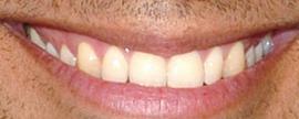 Picture of Wilmer Valderrama teeth and smile