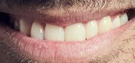 Picture of Wilmer Valderrama teeth and smile