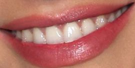 Picture of Witney Carson teeth and smile