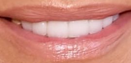 Picture of Yolanda Hadid teeth and smile