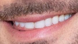 Image of Zac Efron's teeth and smile