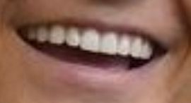 Picture of Zach Wilson teeth and smile